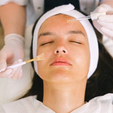 Tratamiento facial con ácidos